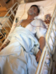 見る方も気持ちのいいものではないと思うので、モザイクにて。